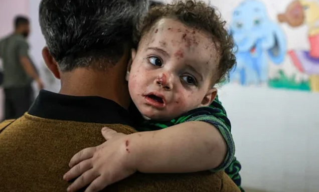 Read more about the article اٹلی کا اسرائیلی حملوں میں زخمی 100 فلسطینی بچوں کے علاج کا اعلان